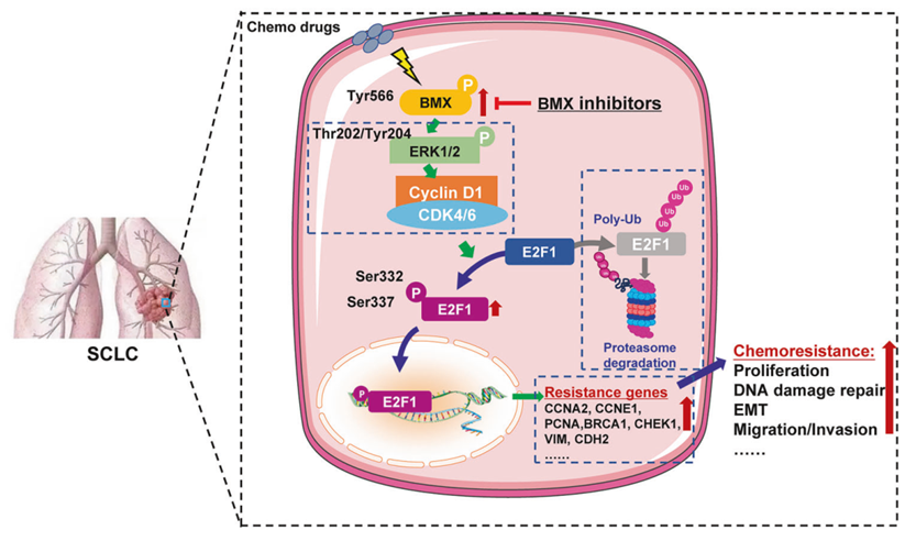 小細胞肺がんの化学療法耐性を克服する新薬候補（New Drug Candidate Shows Promise in Overcoming Chemotherapy Resistance in Small Cell Lung Cancer）
