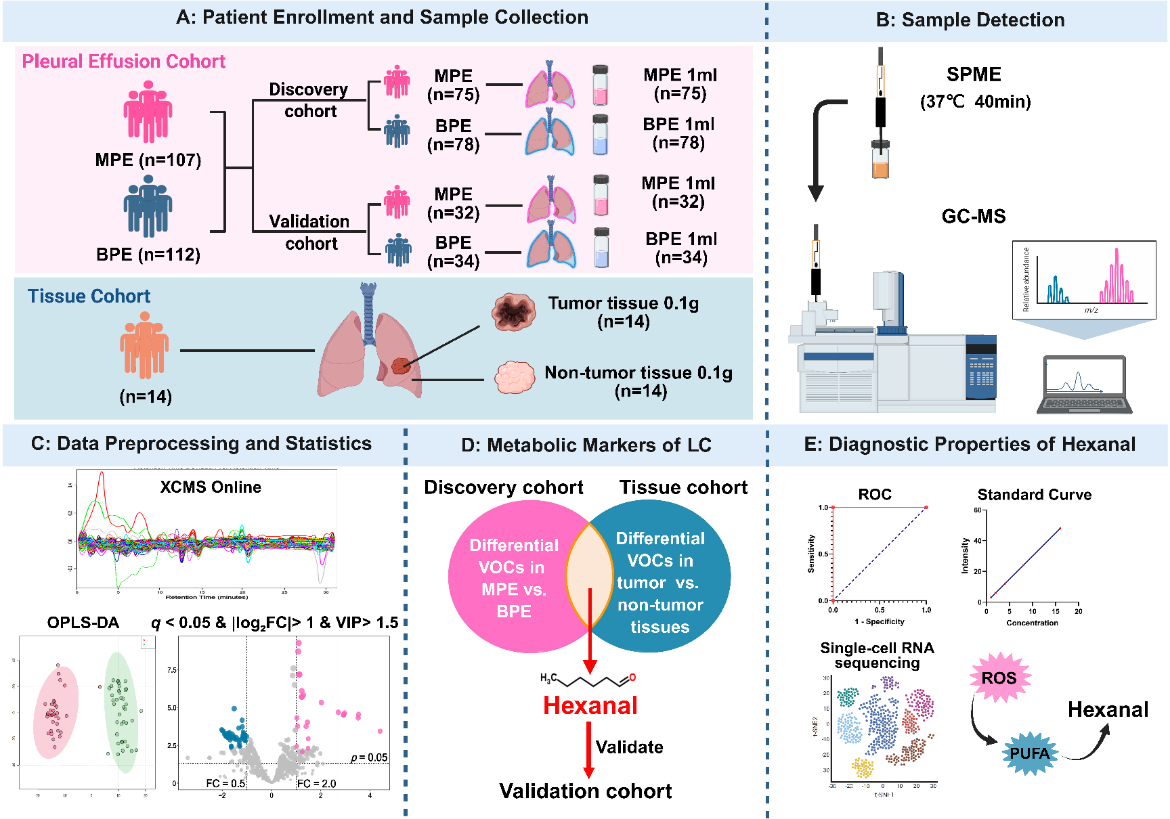 胸水を利用した肺がん診断のための「ガス生検」戦略を開発（Scientists Develop “Gas Biopsy” Strategy for Lung Cancer Diagnosis Using Pleural Effusion）