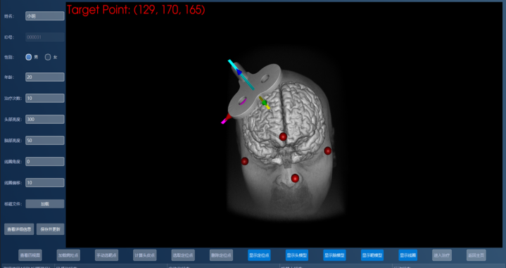 精密脳刺激治療のための知能ロボットの開発（Researchers Develop Intelligent Robot for Precision Brain Stimulation Therapy）